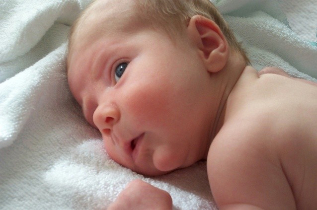 Pele Do Bebe 3 Lesoes Comuns Nos Primeiros Meses Pele Do Bebe 3 Lesoes Comuns Nos Primeiros Meses